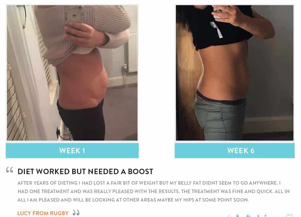 Before and After Dieting Earls Barton