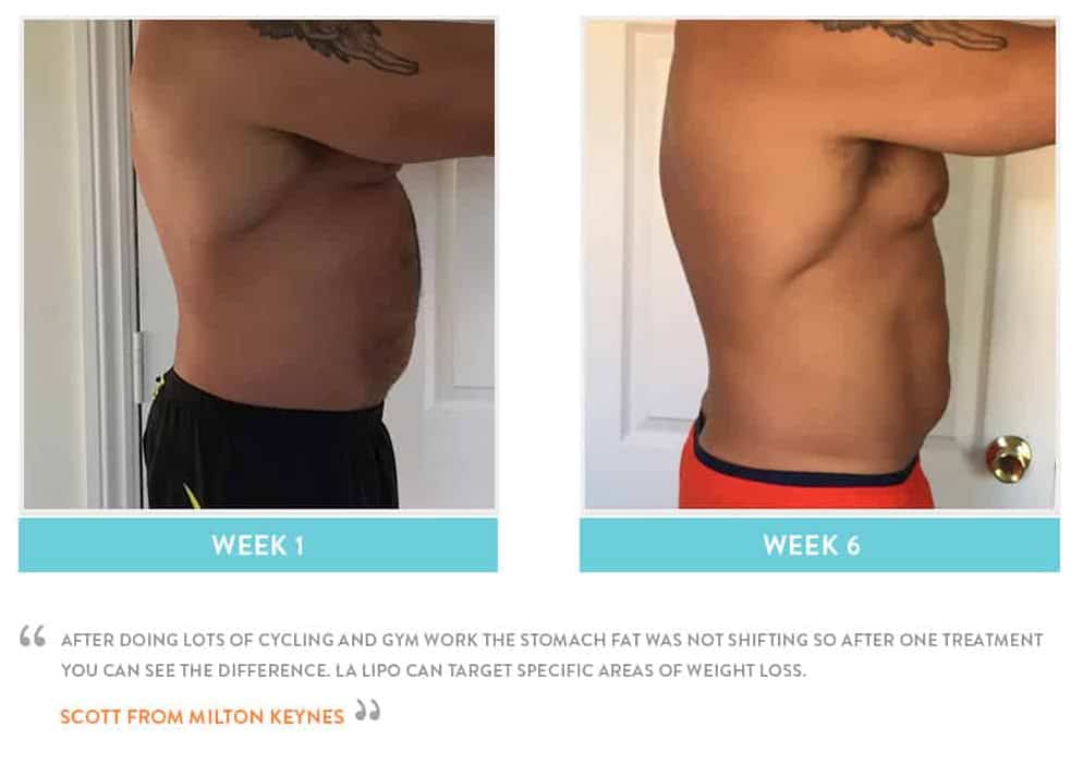 Before & After Stomach Fat Earls Barton