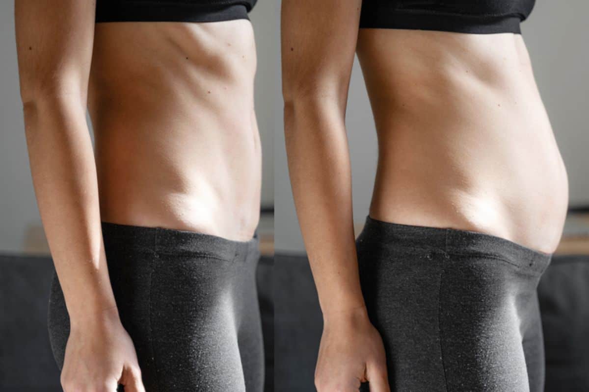 How long does diastasis recti take to improve Earls Barton?