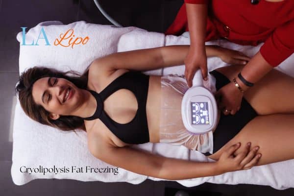 woman getting cryolipolysis Earls Barton