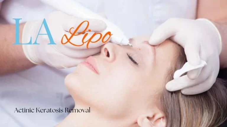 Woman receiving Actinic Keratosis Removal Treatment Earls Barton