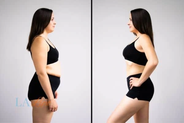 LA-EMS Body Sculpting Earls Barton results before and after of womans results on body toning.