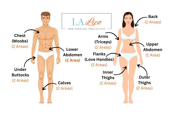 LA LIPO Cryolipolysis Areas Earls Barton