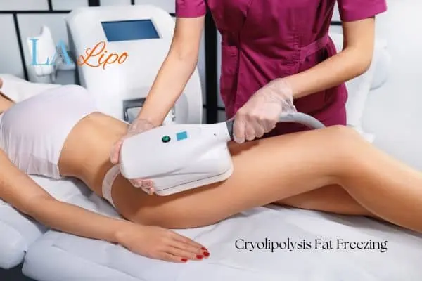 Woman receiving coolsculpting Earls Barton treatment on her thighs