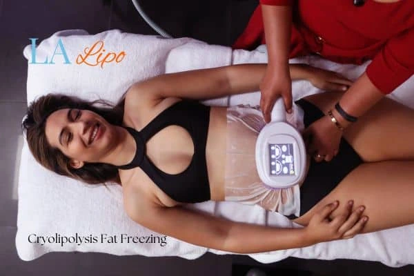 woman getting cryolipolysis Earls Barton