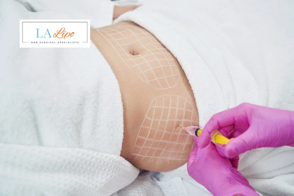 aqualyx fat dissolving injections Earls Barton