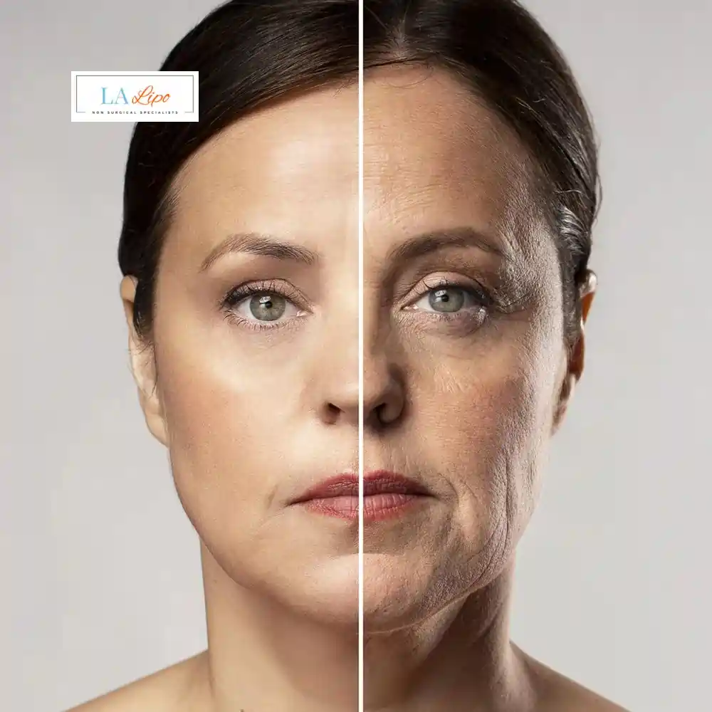 How Can You Tell If Non-Surgical Skin Tightening Is Right for You Earls Barton?