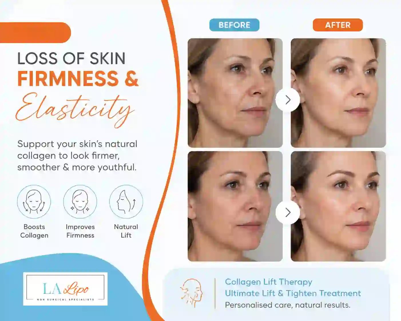 Sign #7: Loss of Skin Firmness and Elasticity Earls Barton