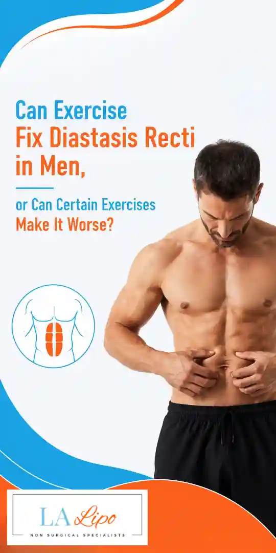Can Exercise Fix Diastasis Recti in Men, or Can Certain Exercises Make It Worse Earls Barton?