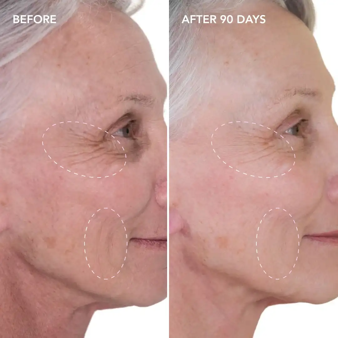 When will you see results Earls Barton